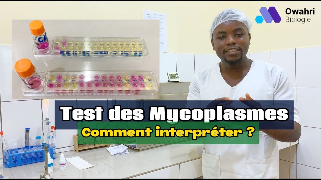 Guide complet pour interpréter les tests de culture des mycoplasmes sur milieu liquide