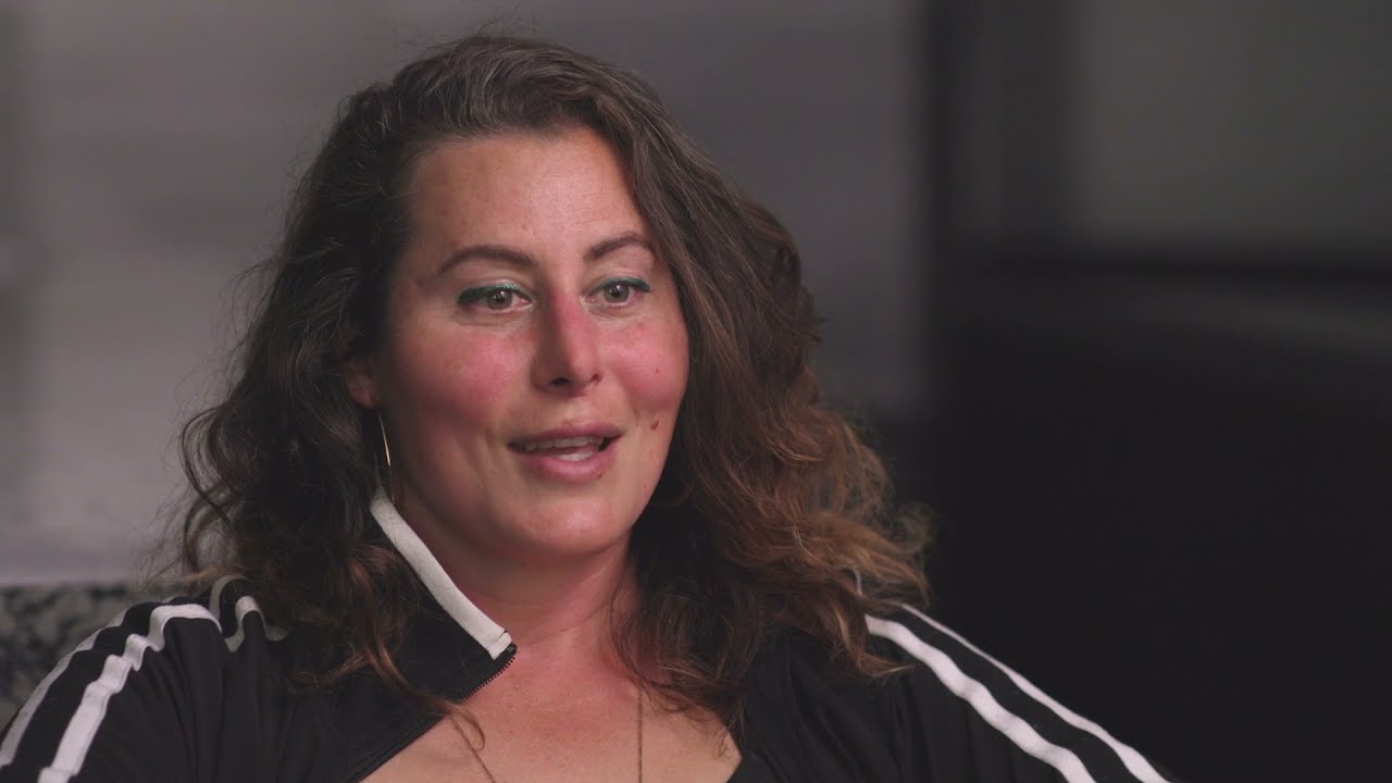 Hair Restoration in the Transgender Community | Ransom/MD