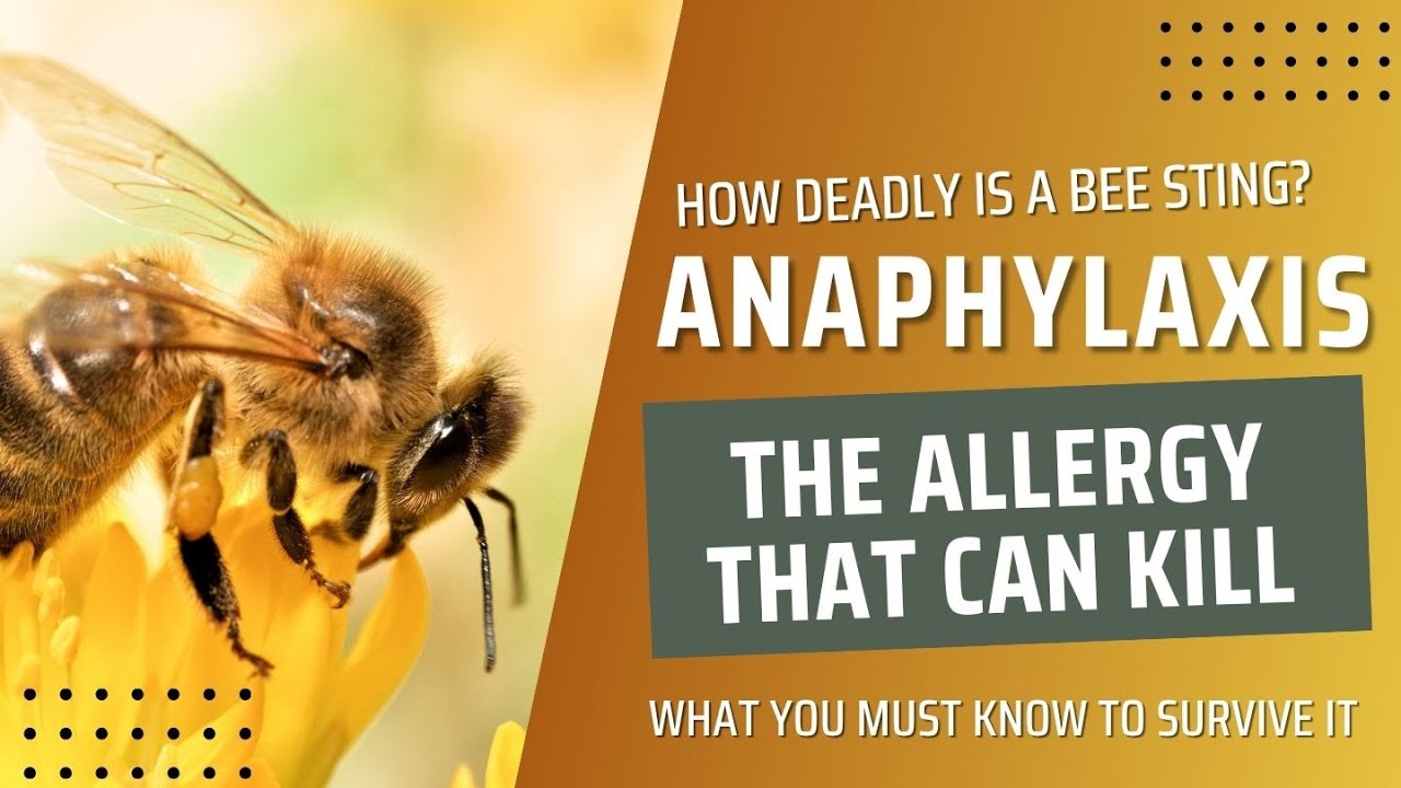 How Deadly is a Bee Sting? Anaphylaxis: The Allergy That Can Kill &mdash; What You MUST Know