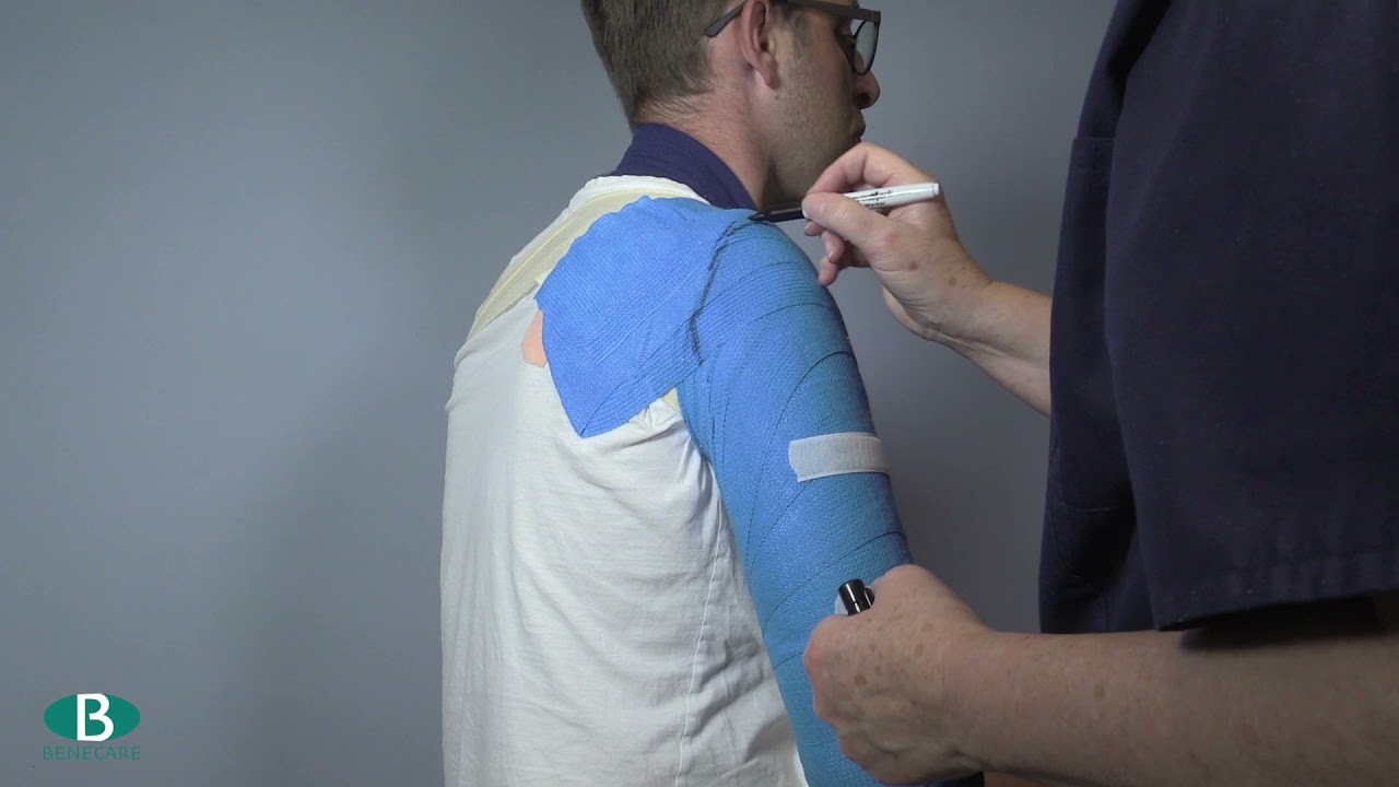 FRC Humeral Brace