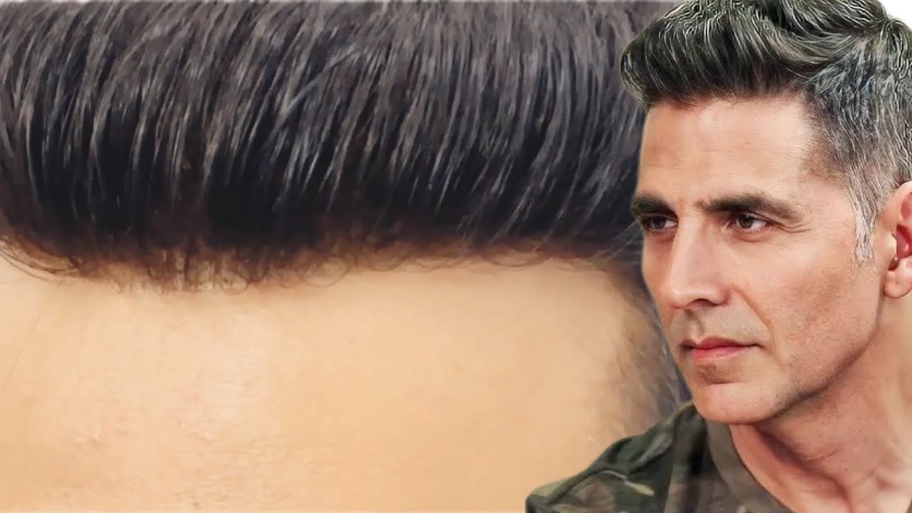 #AkshayKumar Hair Patch service for men Delhi| Natural lace Hair Wigs Non surgical hair replacement
