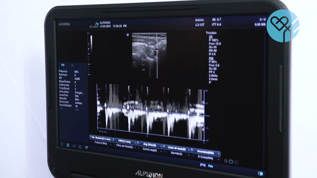 Ultrasonido ALPINION E-CUBE i7 💎