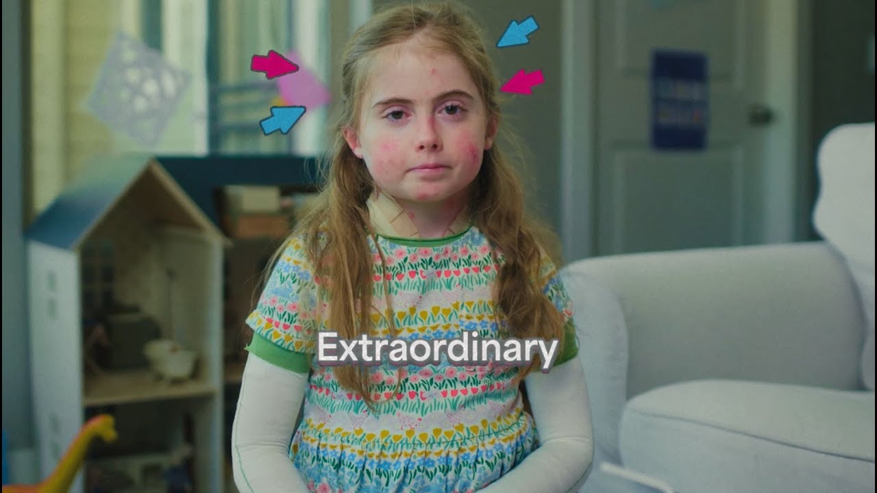 EPIDERMOLYISIS BULLOSA: FROM THE UNKNOWN TO THE UNSTOPPABLE