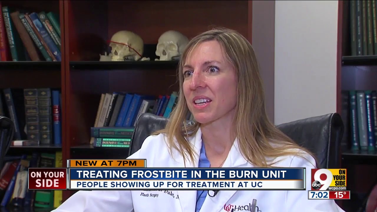 Treating frostbite at UCMC's burn unit