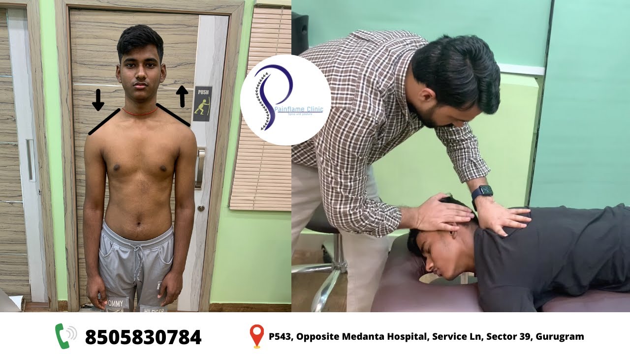 Postural Treatment By Chiropractor | INSTANT RESULTS for Rounded Back And Shoulder |Dr Harish Grover