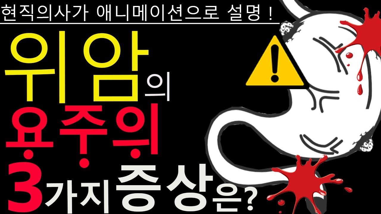 위암, 절대 놓치면 안 되는 초기 증상 3가지