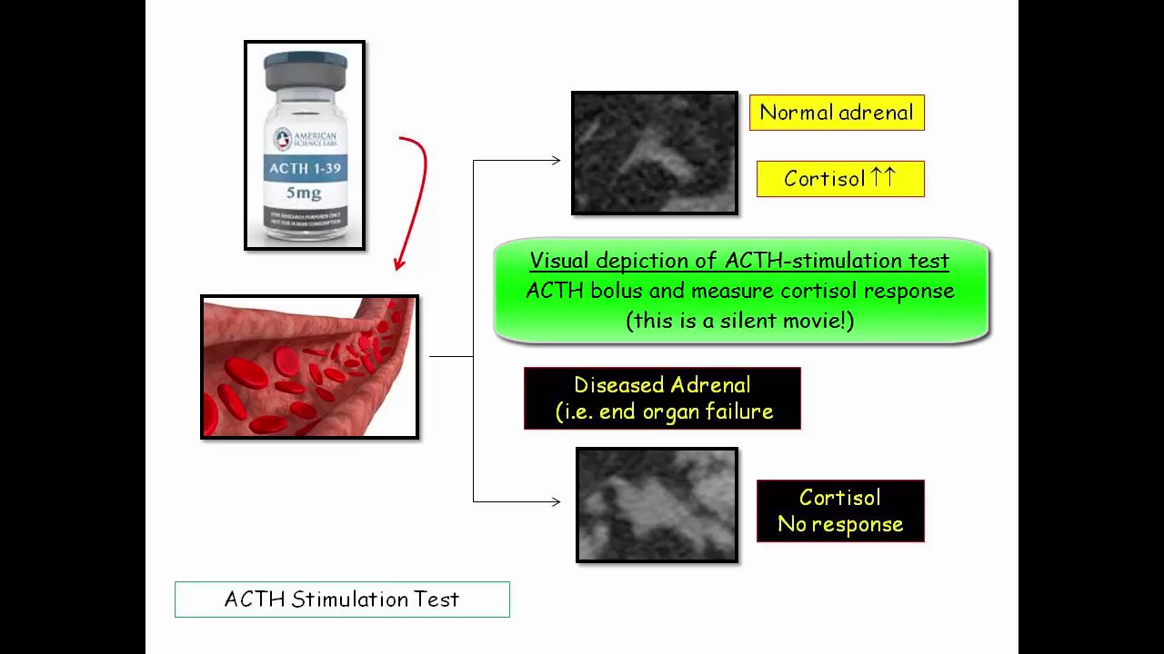 12DaysinMarch, Hypocortisolism for USMLE Step One (Part II)