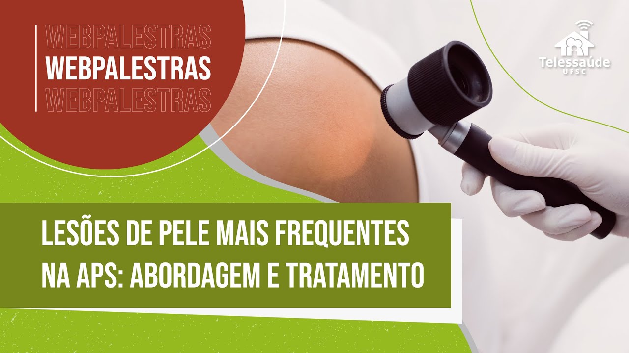 Webpalestra - Lesões de pele mais frequentes na APS: abordagem e tratamento