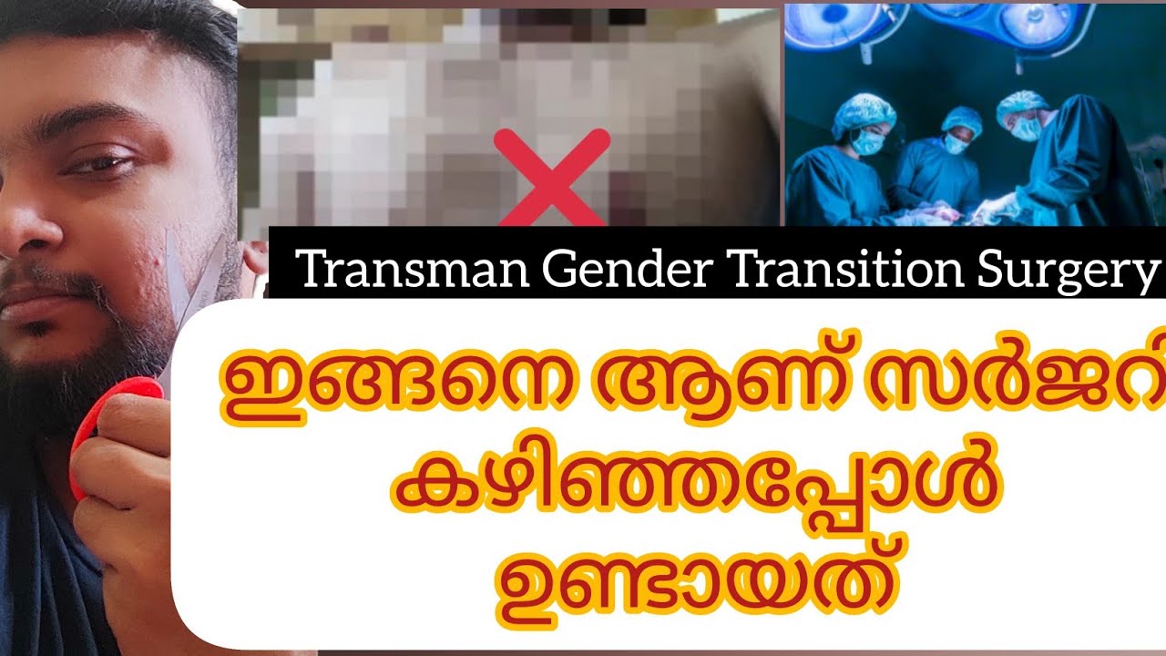 Gender Transition Surgery of Transman 