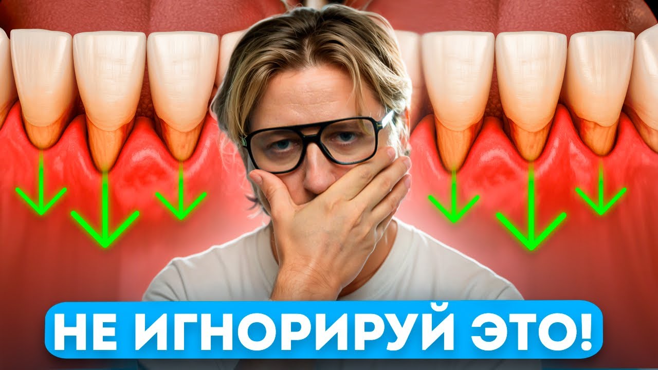 Топ 3 способа остановить рецессию Десны БЕЗ ОПЕРАЦИИ!