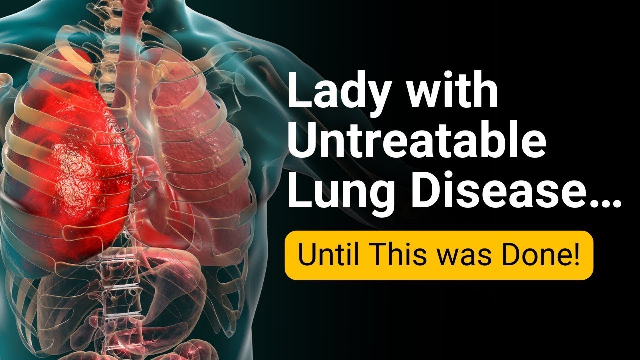 Lady with Untreatable Lung Disease Avoids a Possible Transplant.  Find out How!