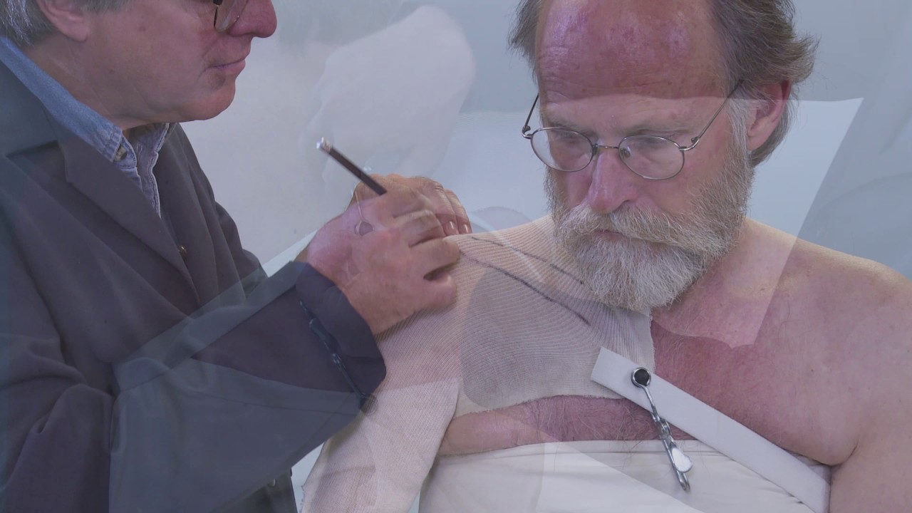 Molding and Fitting Techniques for the Utah Arm