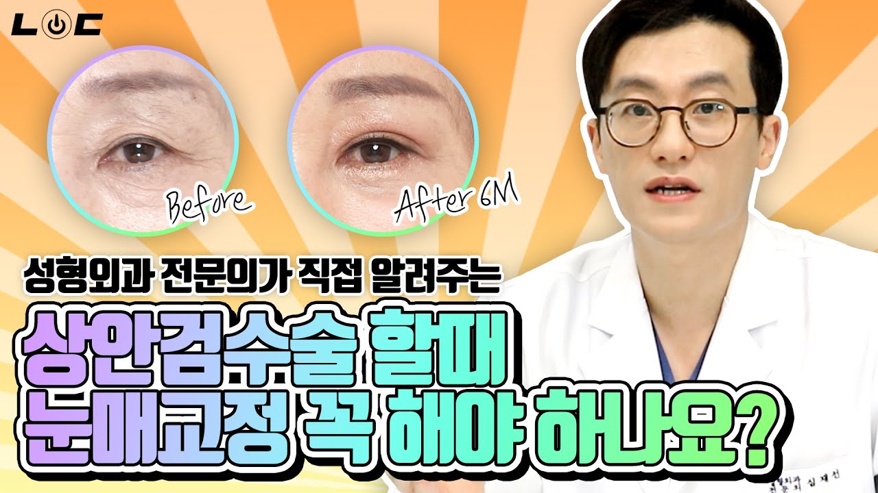 상안검 수술 할 때 눈매교정 꼭 해야 하나요?