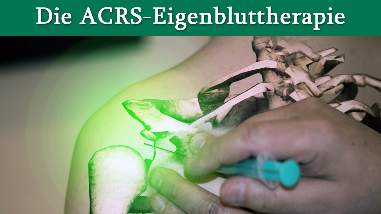Die ACRS-Eigenbluttherapie | Dr. med. Dirk Wiechert