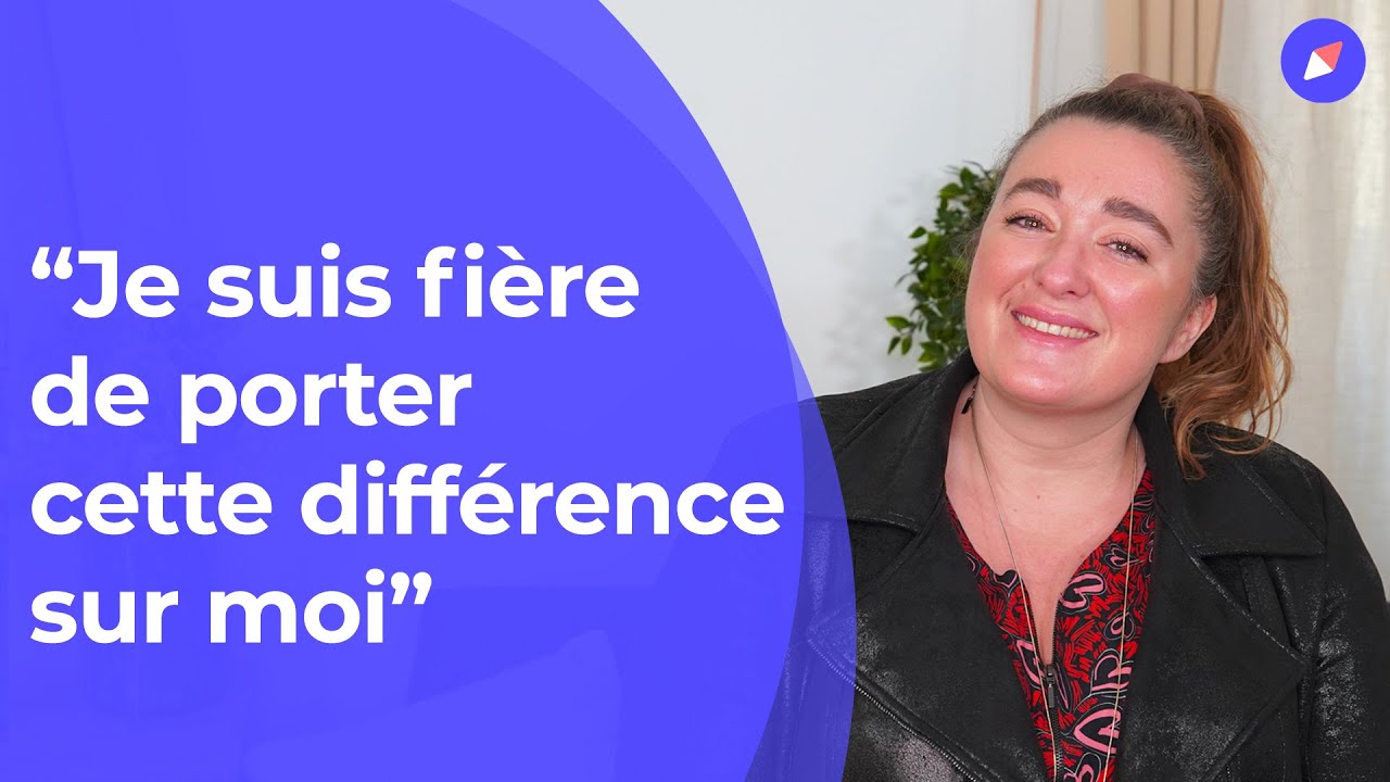 Témoignage : Julie a des angiomes sur 70% de son corps