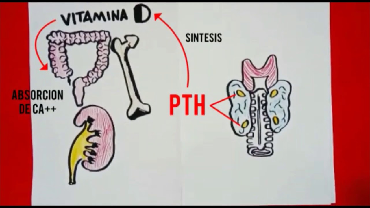 Hipocalcemia post tiroidectom&iacute;a