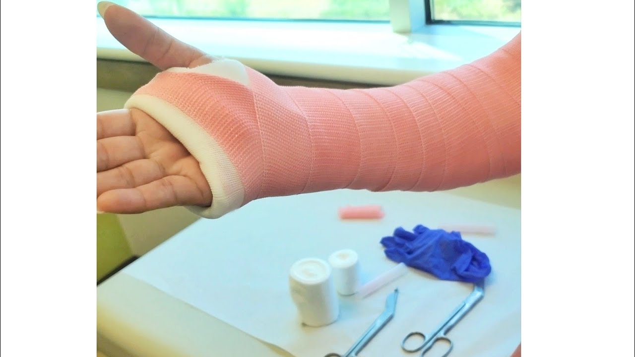How to Make a Supinated/Pronated Long Arm Cast