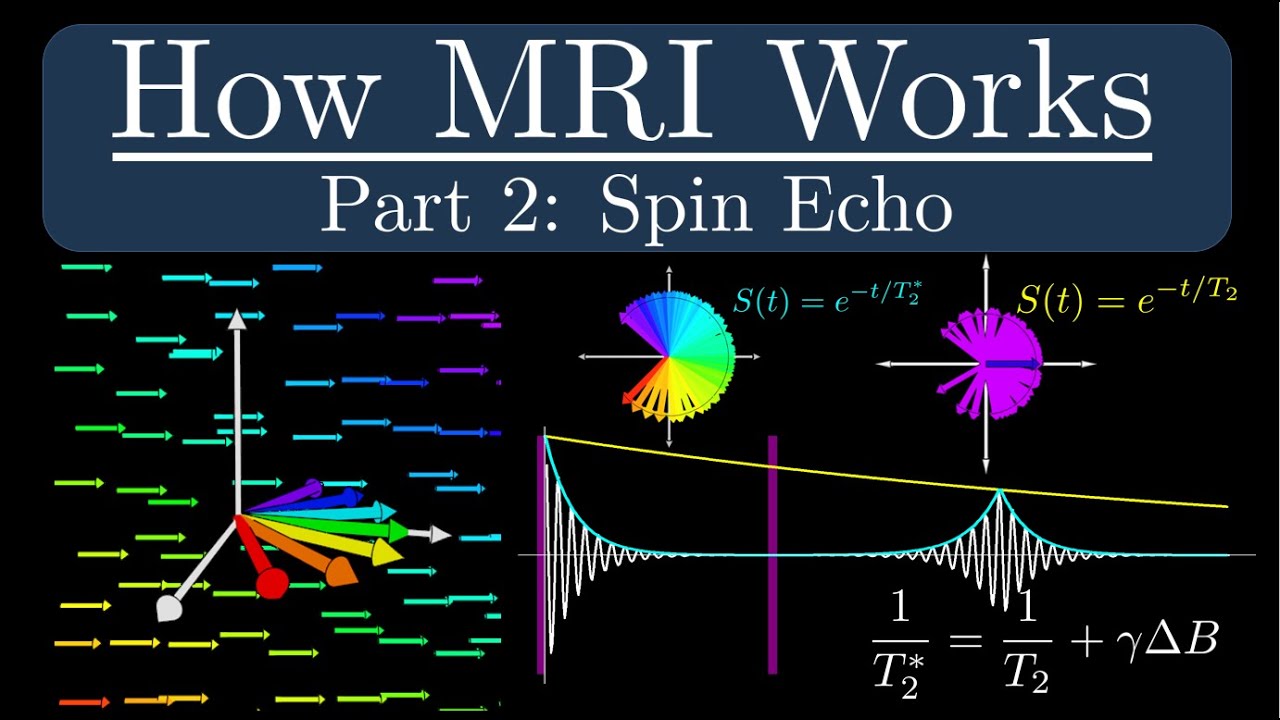 How MRI Works - Part 2 - The Spin Echo