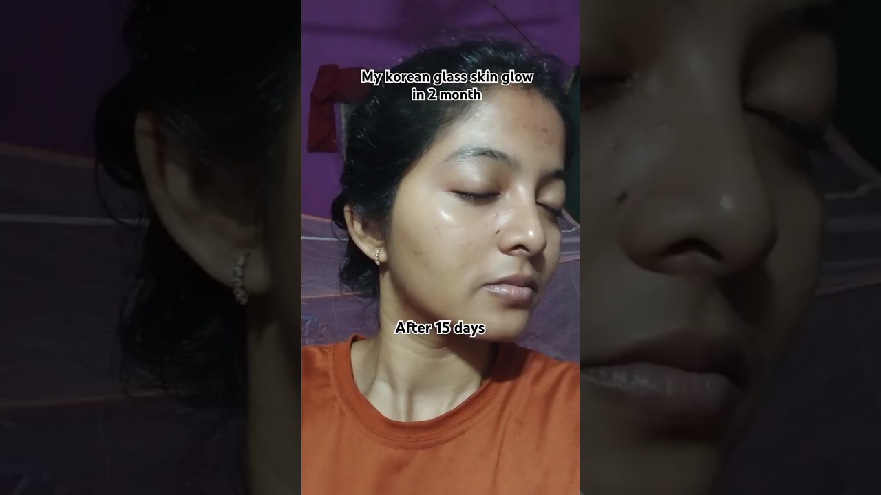korean glass skin in just 2 months#skincare #koreanskincare #glassskin #shorts