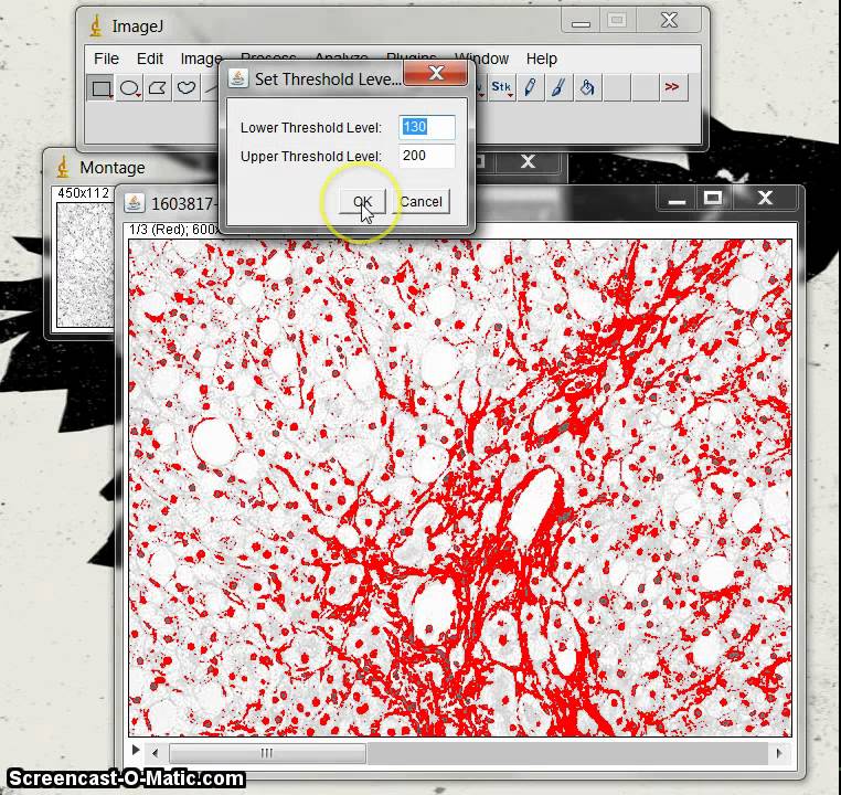 Quantifying Stained Liver Tissue Area Using ImageJ