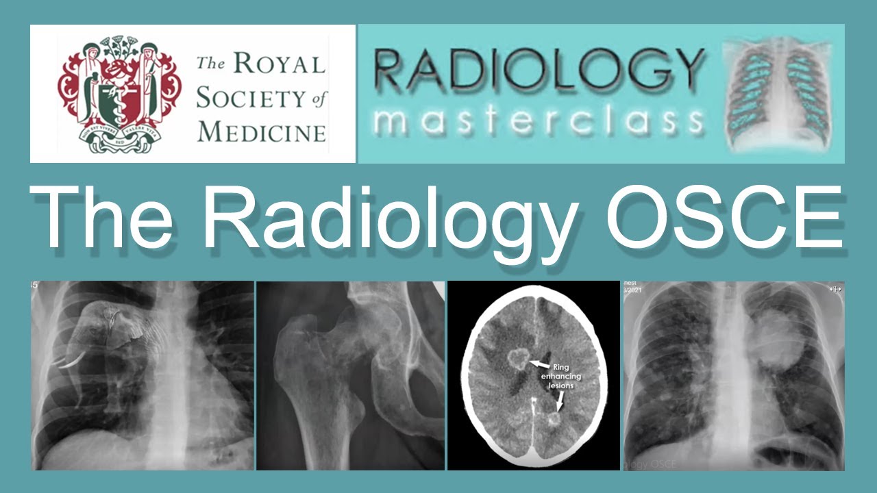 The Radiology OSCE