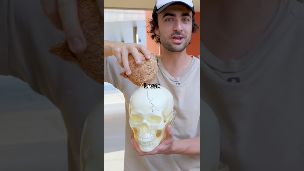 What if coconut falls on your head? #shorts #skull #interesting #usa #uk #europe #coconut