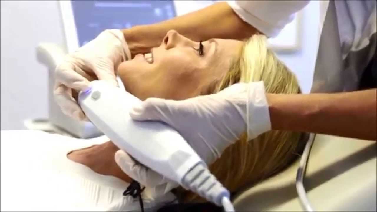 Ultherapy on Alive & Well