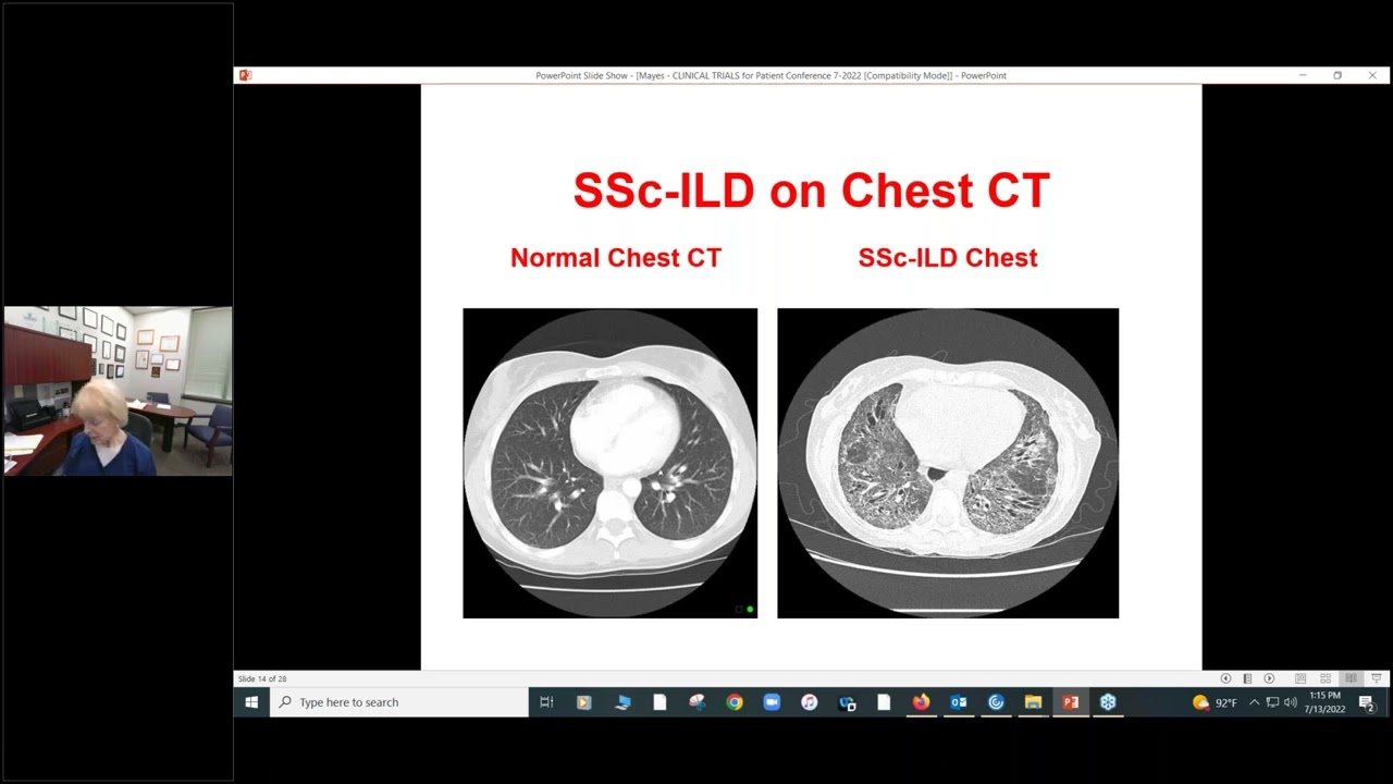 Scleroderma Clinical Treatment Trials- Are They Right For You? Maureen D. Mayes, MD, MPH