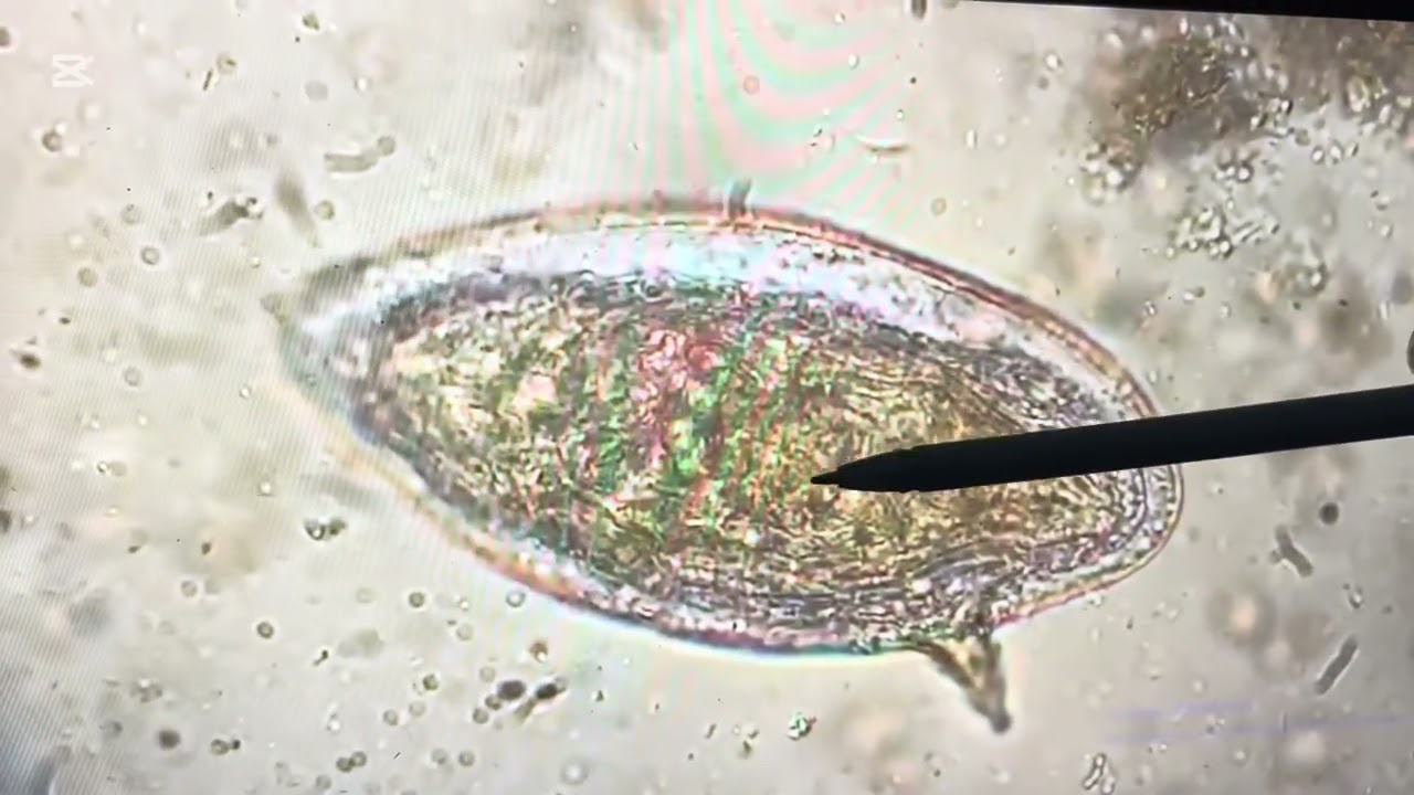 Description de quelques parasites et œuf de parasites ainsi que des kystes lors de l’examen de selle