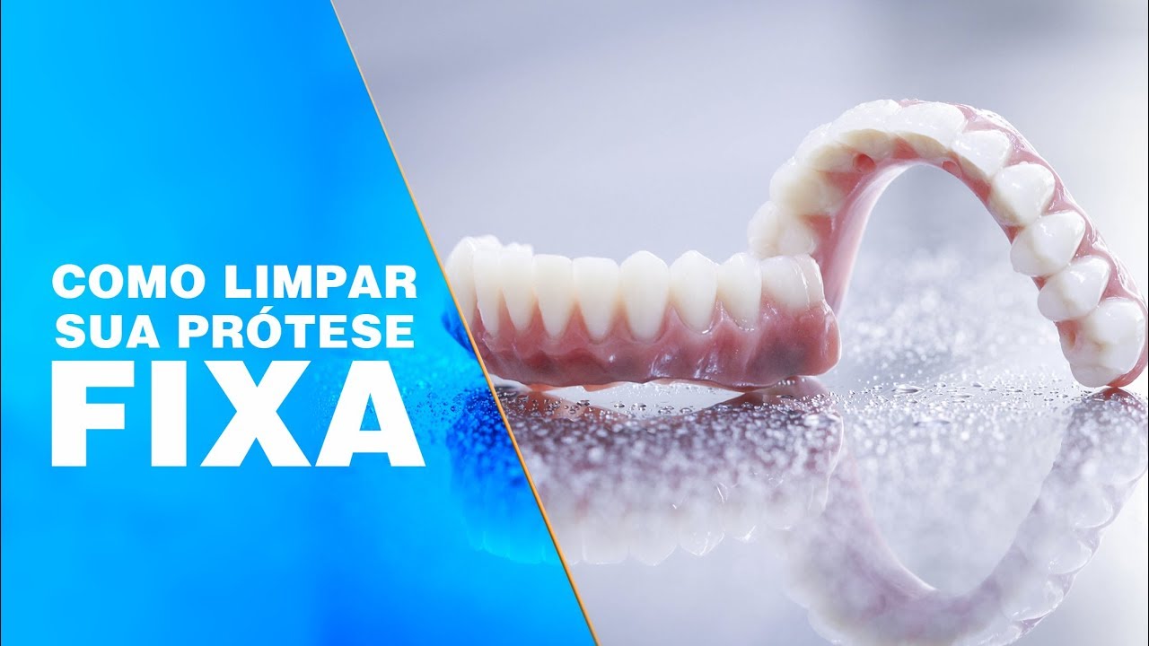 Como Limpar Pr&oacute;tese com Implantes (Protocolo)