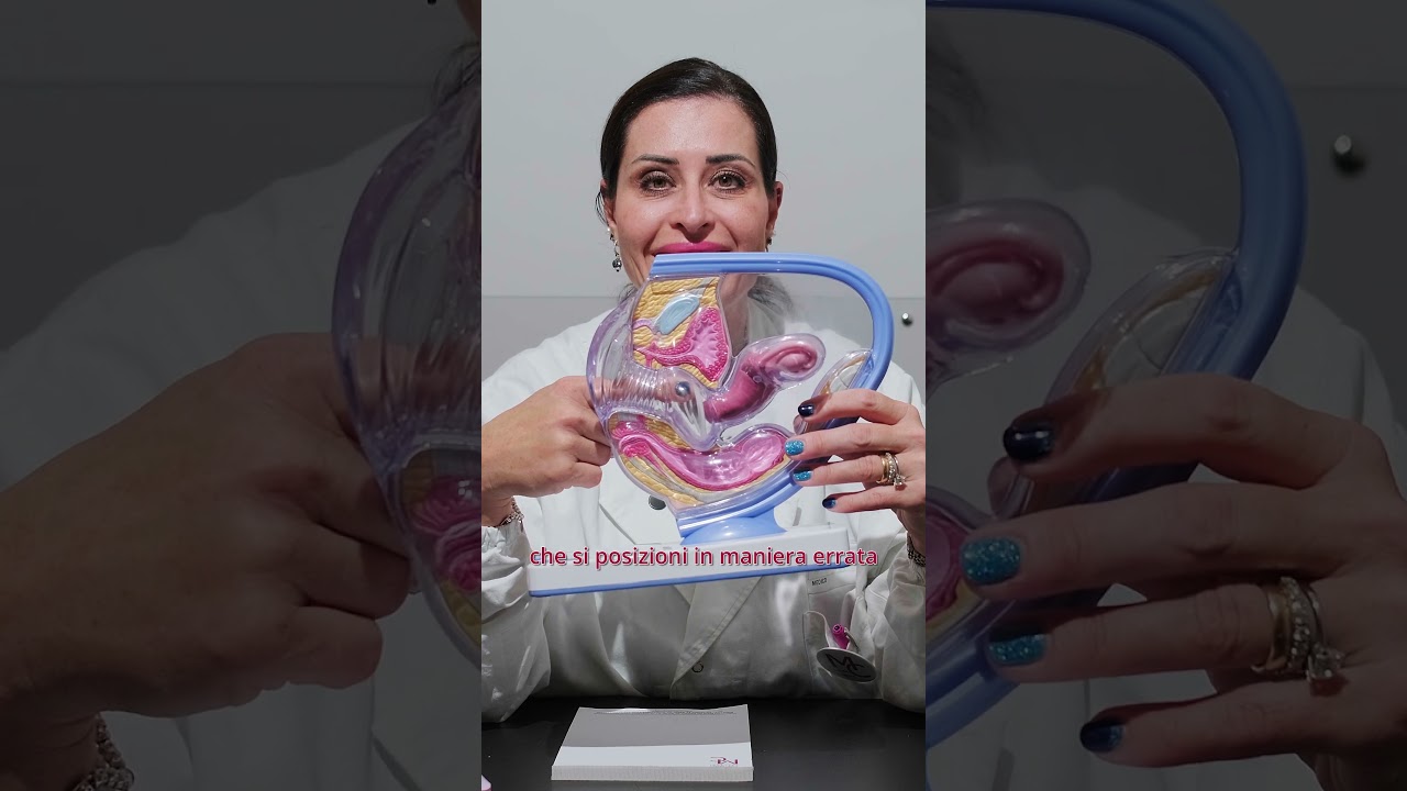 Come si inserisce l'anello #ginecologacalcagni