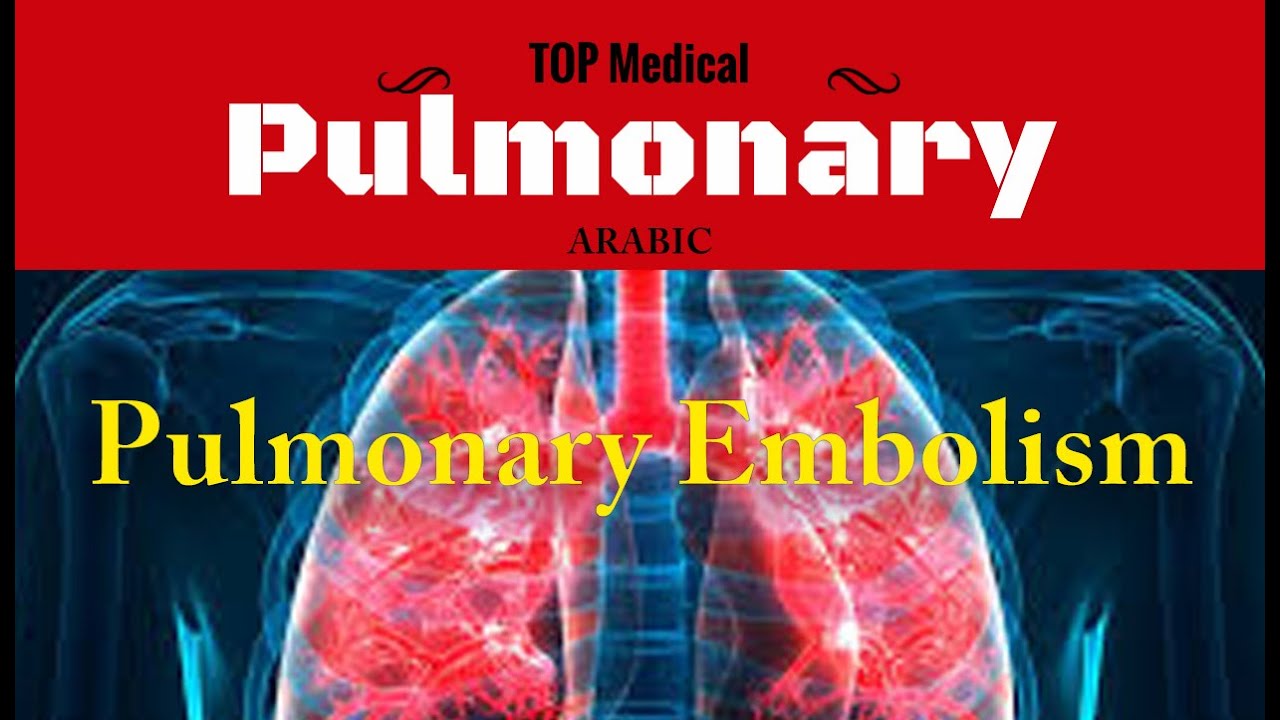 Pulmonary Embolism (Arabic)