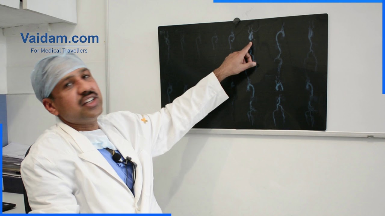 Bentall Procedure - Best Explained by Dr. Sanjeev Kumar Singla of Medanta Hospital, Gurgaon