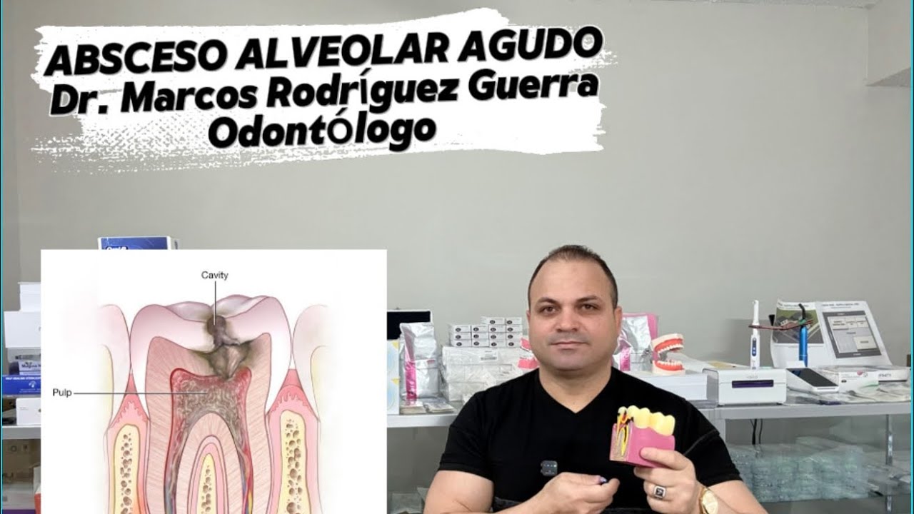 Absceso alveolar agudo: causas, síntomas y tratamiento dental #AbscesoAlveolar #DolorDental #Odontot