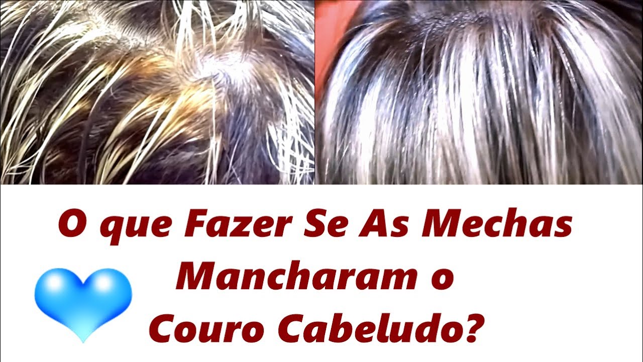 Como Corrigir Couro Cabeludo Manchado Com As Mechas