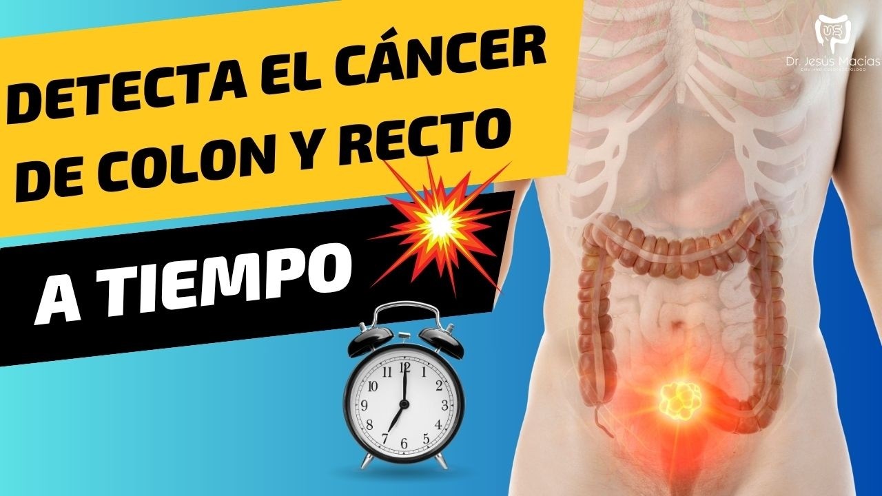 CUANDO se Debe Realizar Una Colonoscopia?