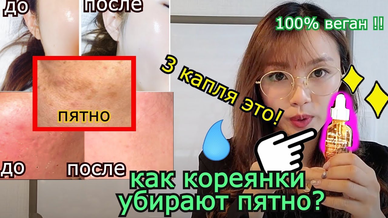 Как кореянки убирают пятно и веснушки! 3 Капля Сыворотка! 한국에서 기미를 없앨 때 하는 방법! with jumiso кенха경하
