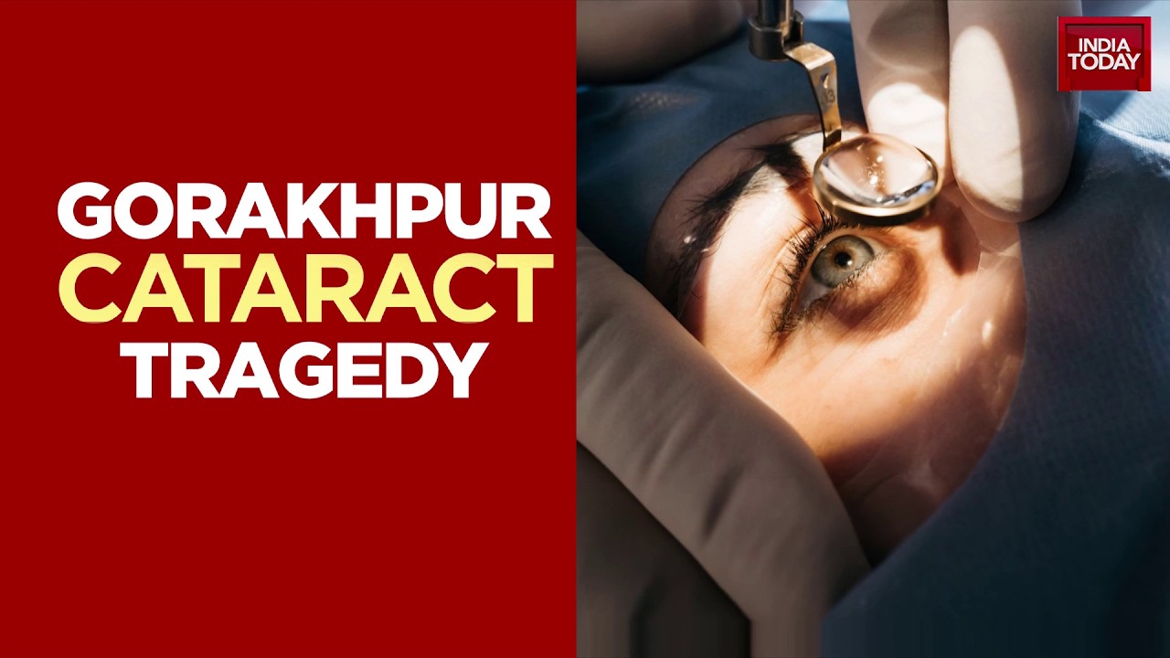 Gorakhpur Cataract Tragedy: 18 Patients Suffer Infections, 9 Lose Eyesight After Botched Surgery