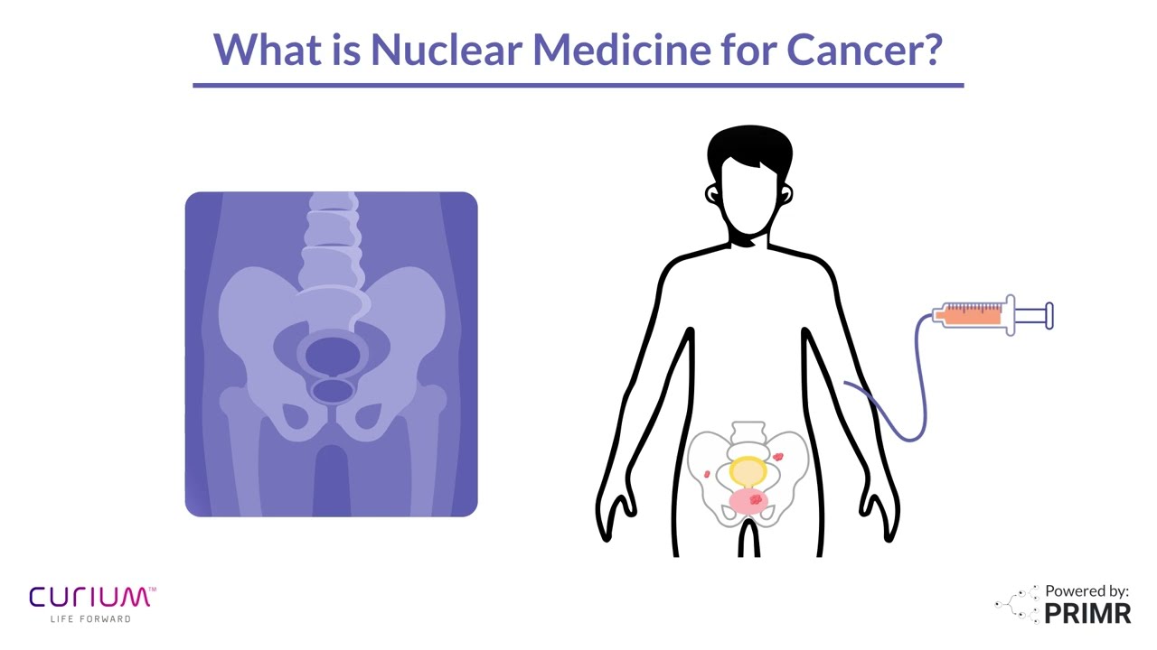Nuclear Medicine for Cancer Explained | Diagnosis and Treatment