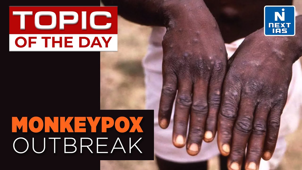 Monkeypox Outbreak | Topic Of The Day | Current Affairs | Next IAS | UPSC
