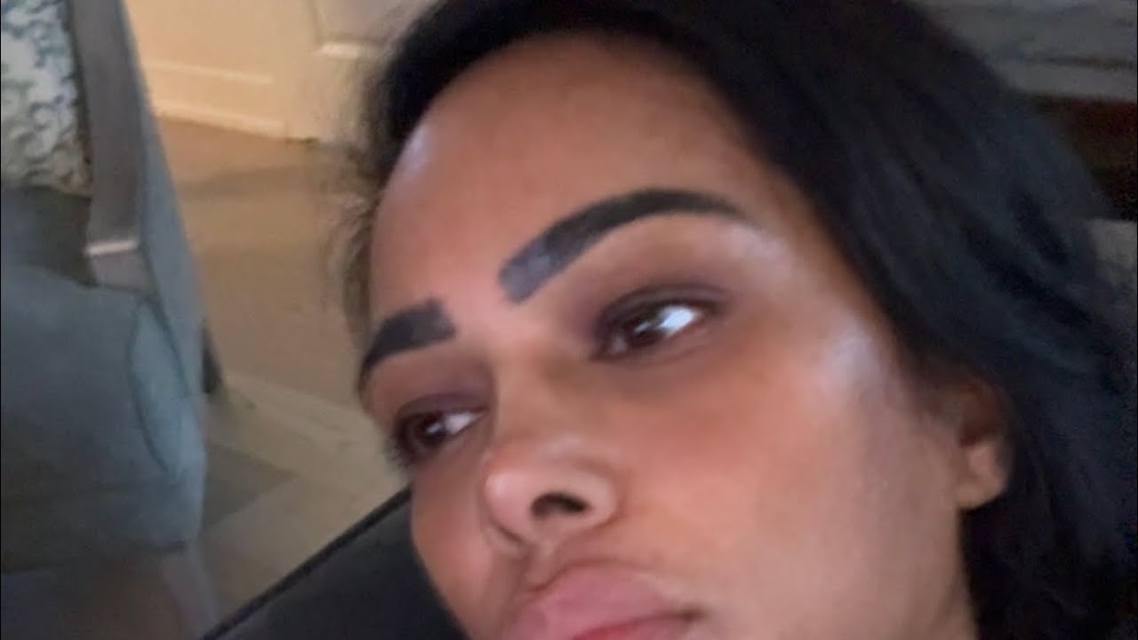 SkinVive Gone Wrong: My Honest Experience & What I Wish I Knew