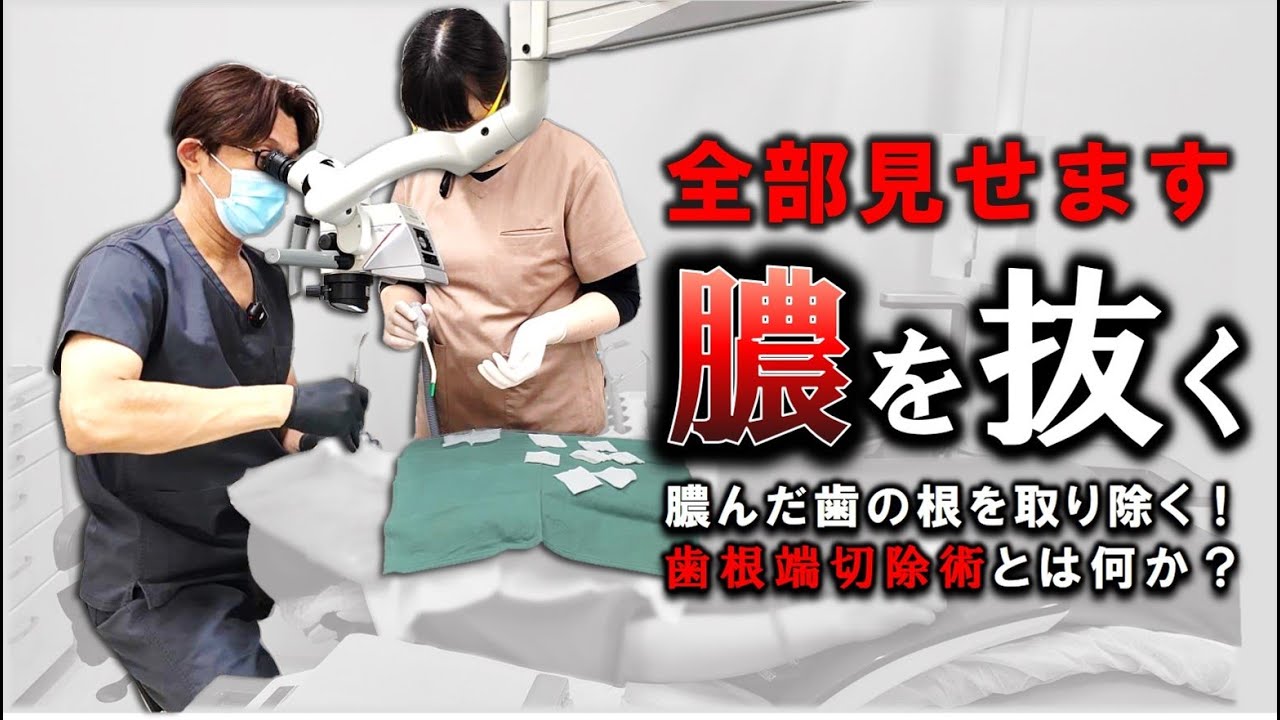 【全部見せます】膿が溜まった歯を治す！そして【祝】銀の盾開封！#歯根端切除術
