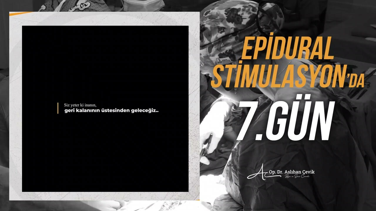 EPİDURAL STİMULASYON dan sonra 7. GÜN