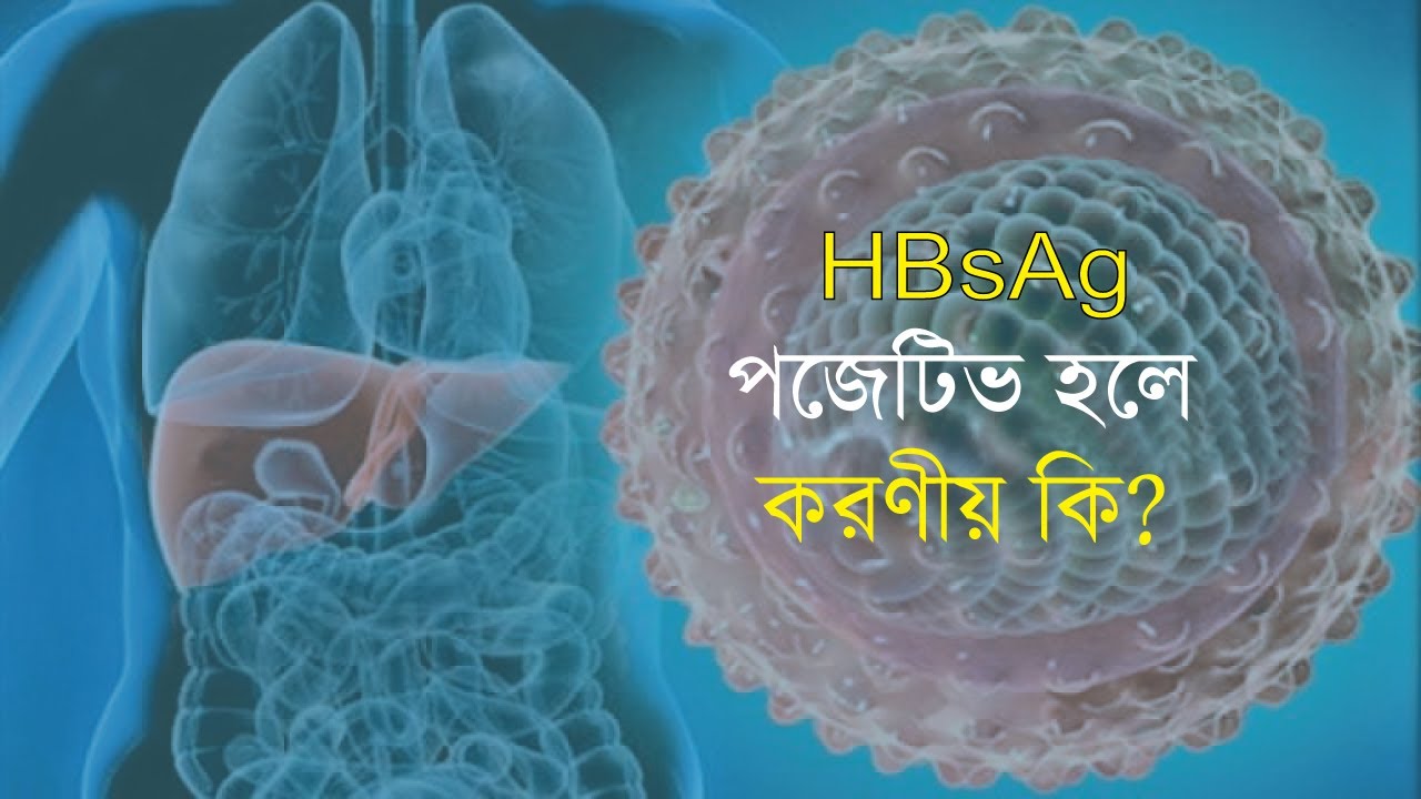 HBsAg পজেটিভ হলে করণীয় কি ?