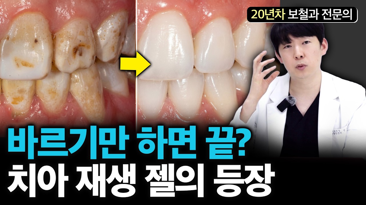 손상된 치아가 회복되는 젤의 등장 치과 진료 이제 겁내지 않아도 된다?
