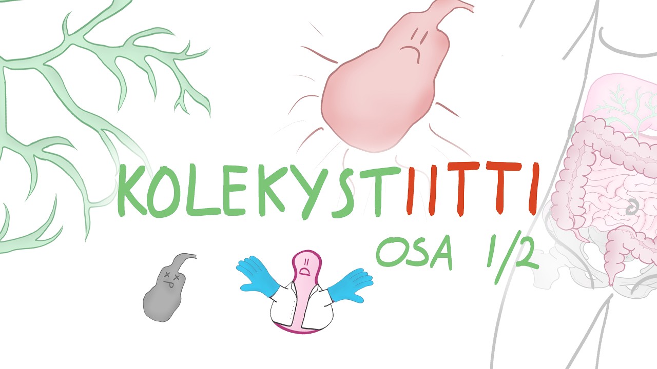 Mikä on Kolekystiitti ja kuinka se syntyy?