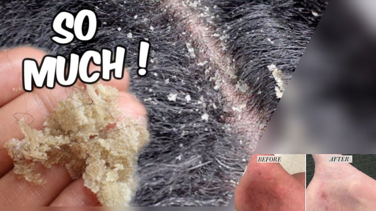 Danthapala ayurvedic oil review /ദന്തപാല എണ്ണ അടിമുടി അഴകിന് 💃_kpz world