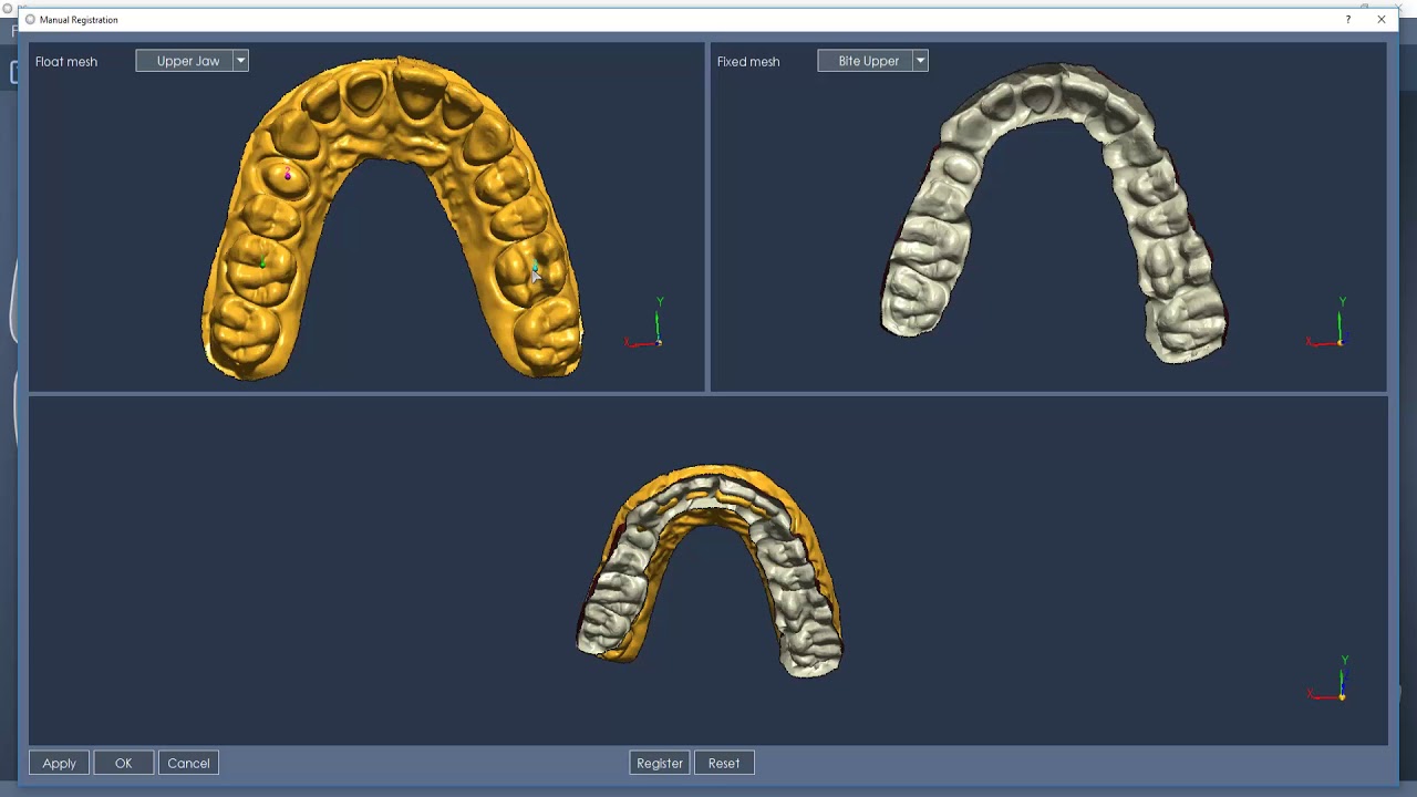 DentalCad 6.4 - New Features