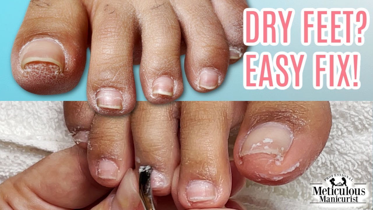 Step by Step Pedicure Tutorial on Dry Feet