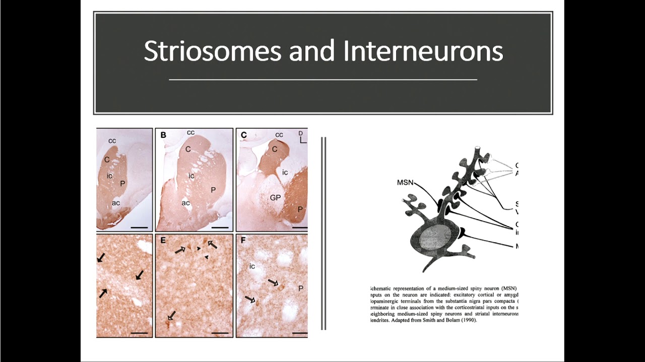 2019 UNMC Parkinson's Disease Conference - How Can We Cure Parkinson's Disease? Part Two